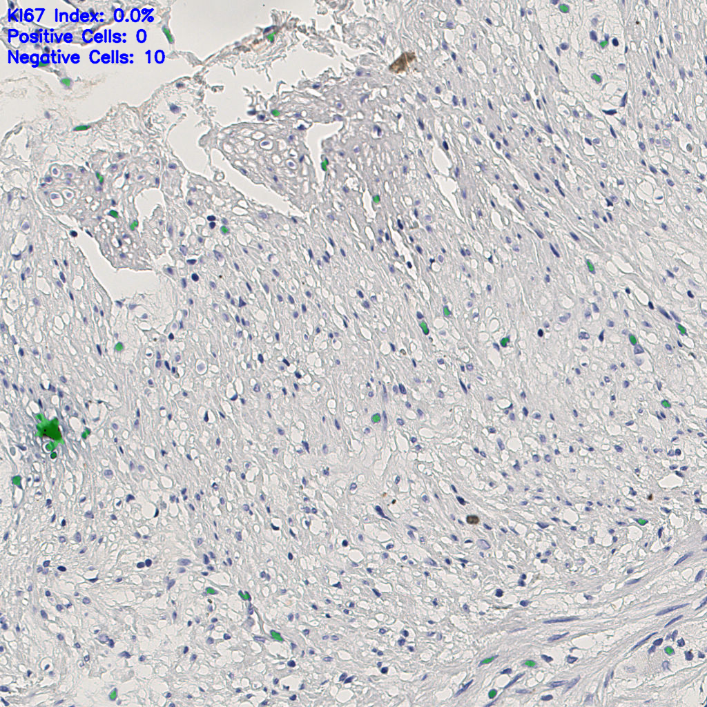 slice_6_20_x5376_y17920.png