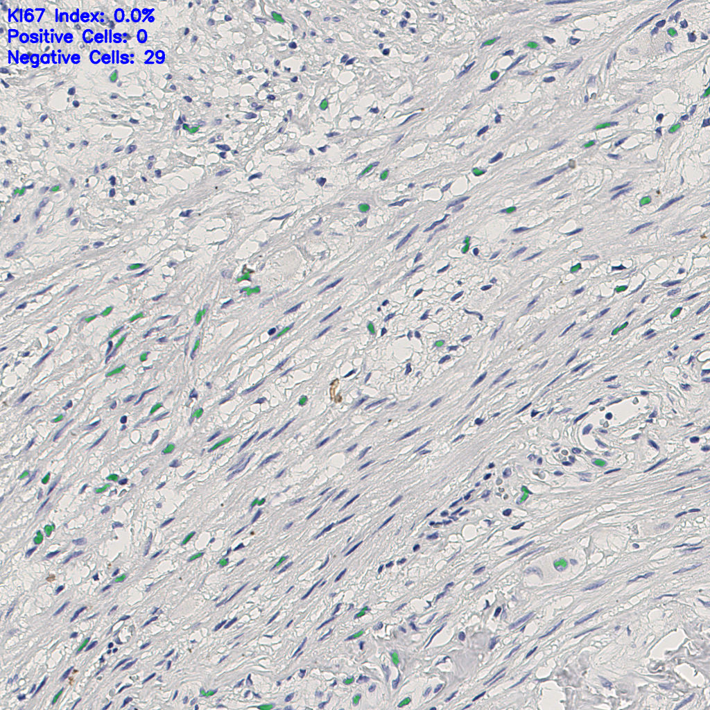 slice_6_21_x5376_y18816.png