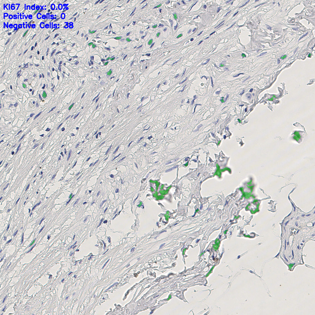slice_6_22_x5376_y19712.png
