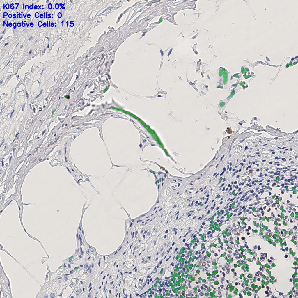 slice_6_23_x5376_y20608.png