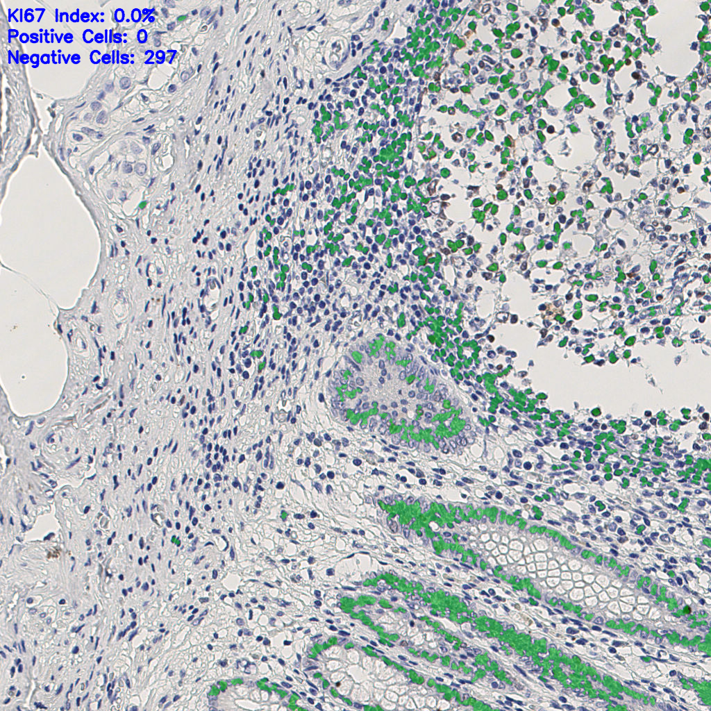 slice_6_24_x5376_y21504.png