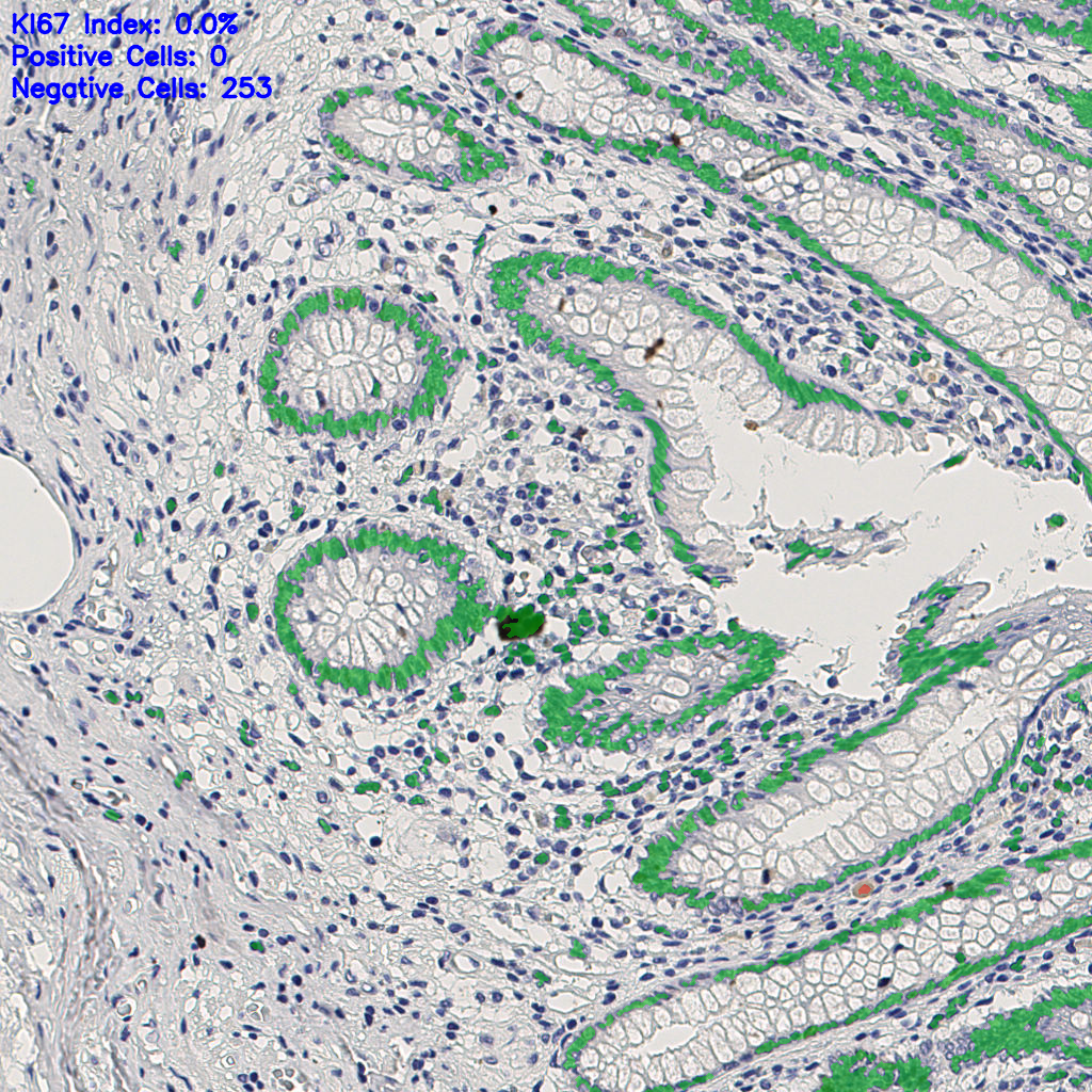 slice_6_25_x5376_y22400.png