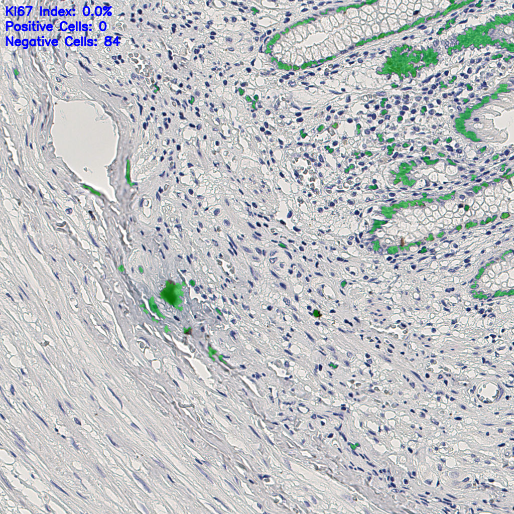 slice_6_26_x5376_y23296.png