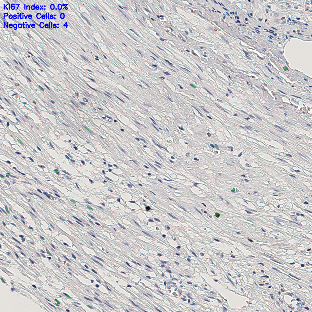 slice_6_27_x5376_y24192.png