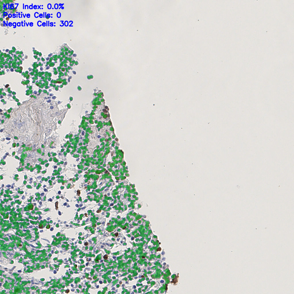 slice_7_13_x6272_y11648.png