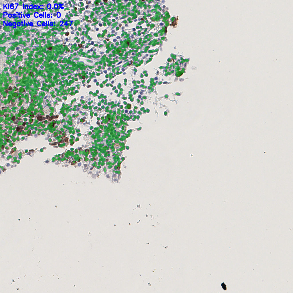 slice_7_14_x6272_y12544.png