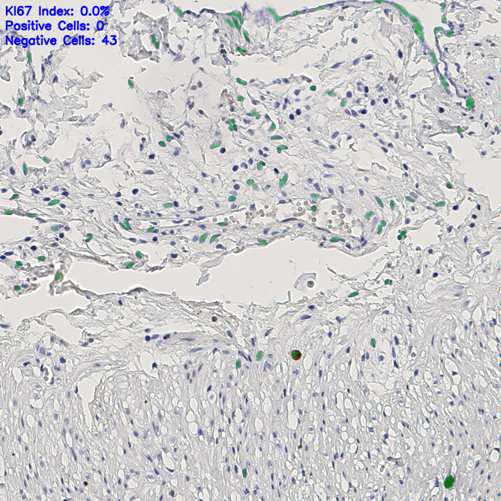 slice_7_19_x6272_y17024.png