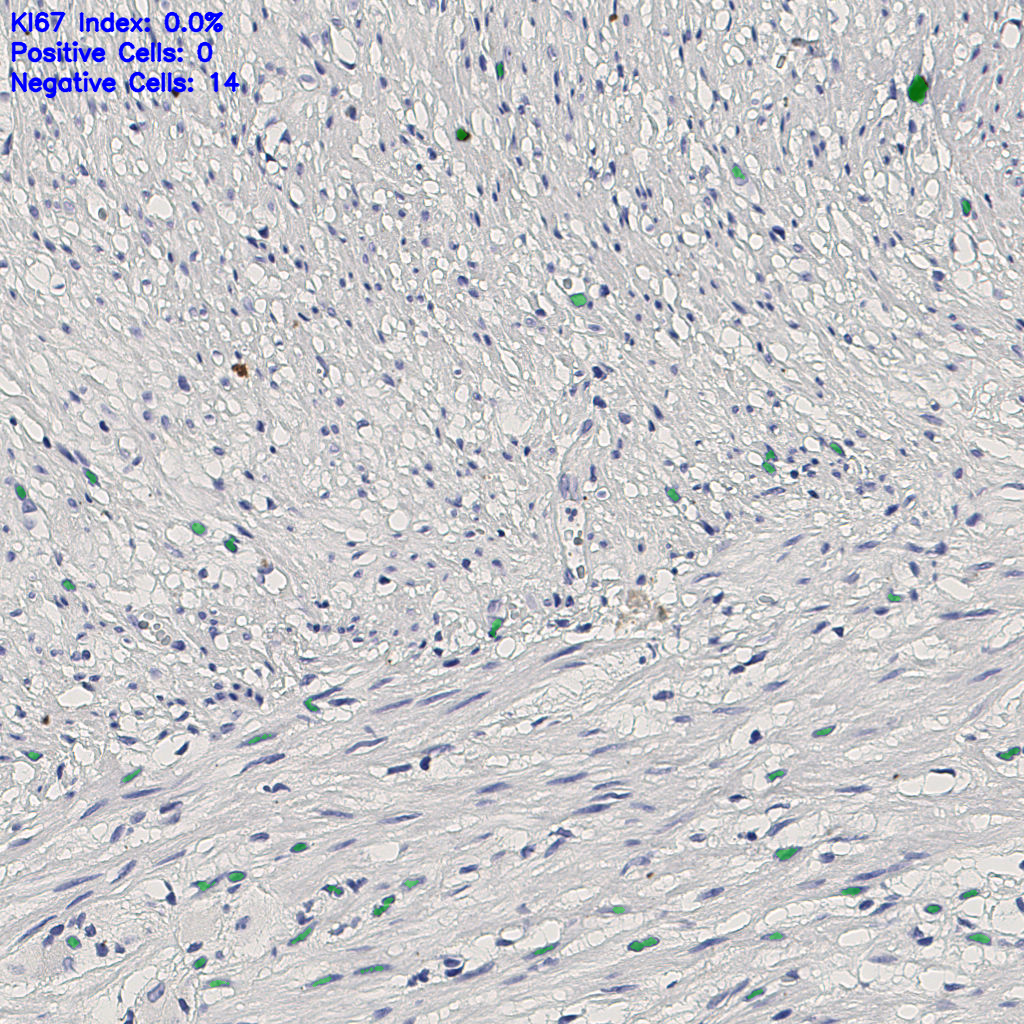 slice_7_20_x6272_y17920.png