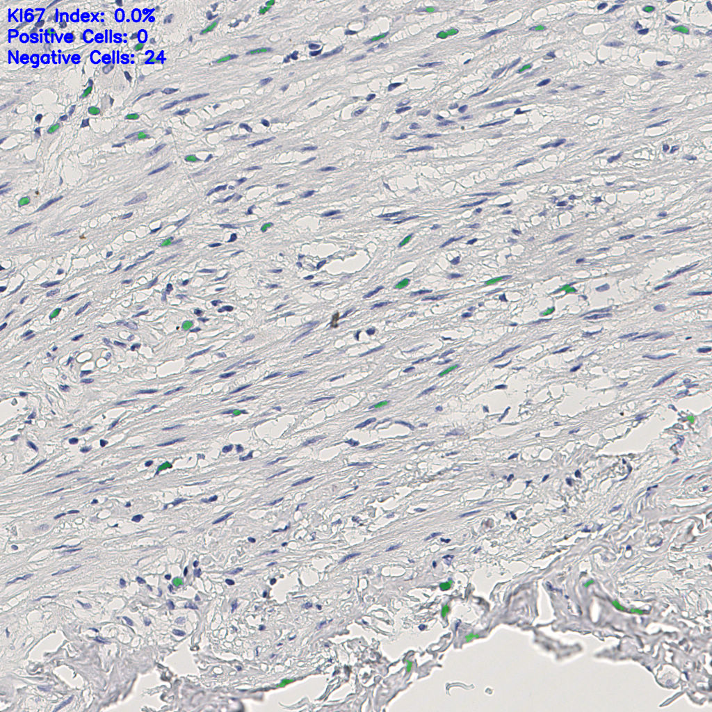 slice_7_21_x6272_y18816.png