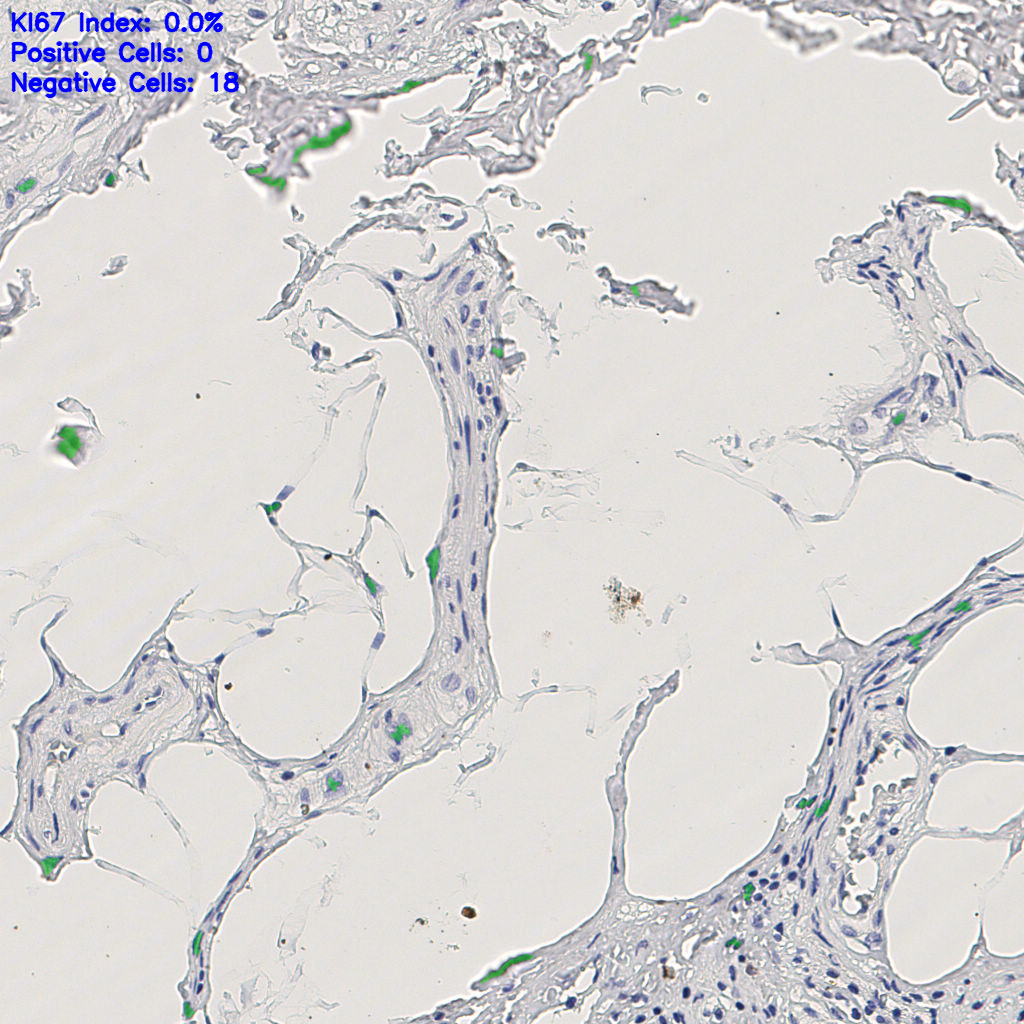 slice_7_22_x6272_y19712.png