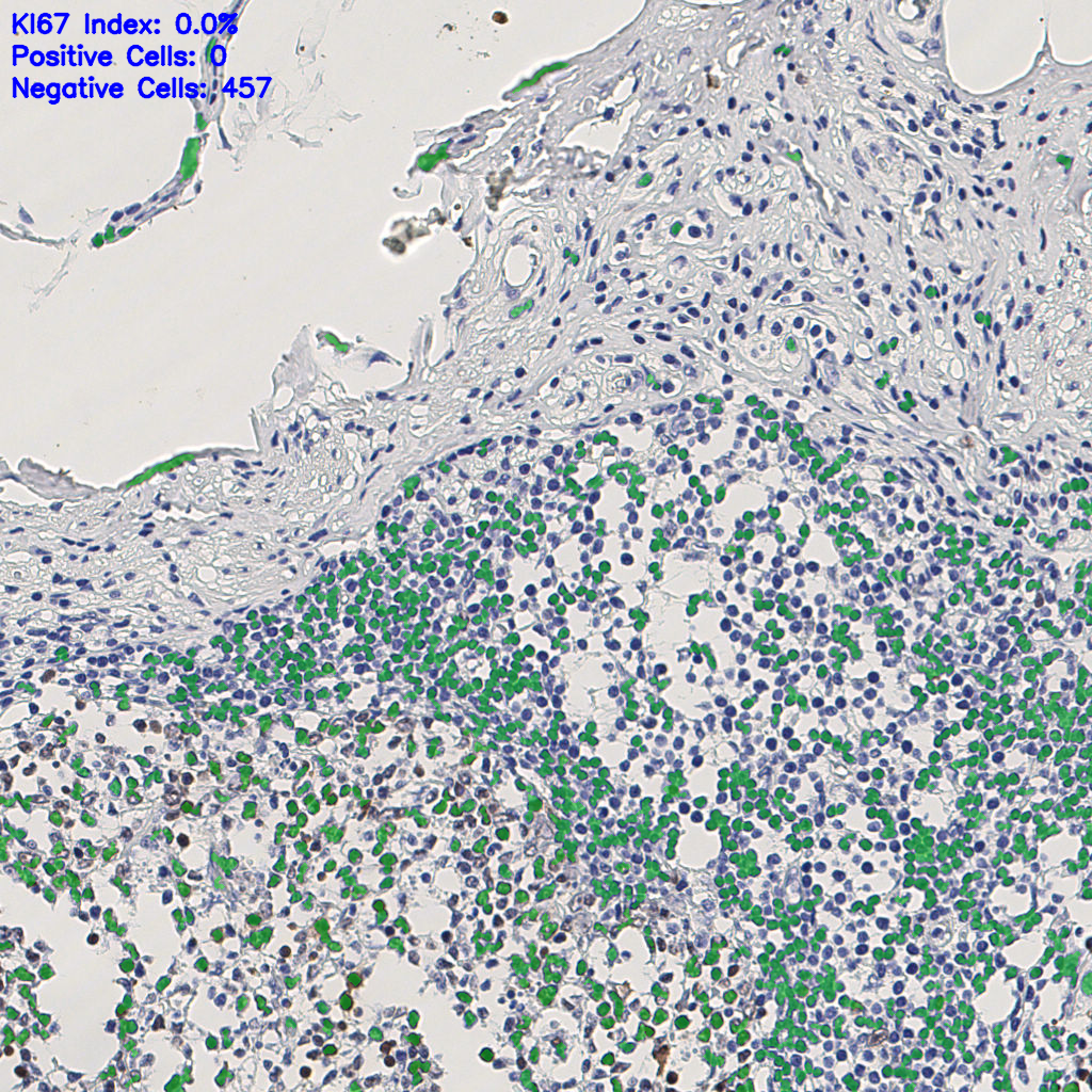 slice_7_23_x6272_y20608.png