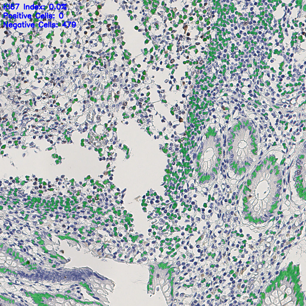 slice_7_24_x6272_y21504.png