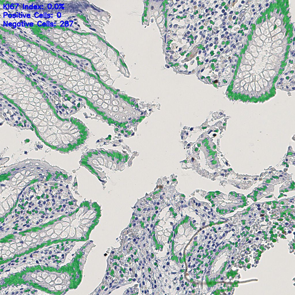 slice_7_25_x6272_y22400.png