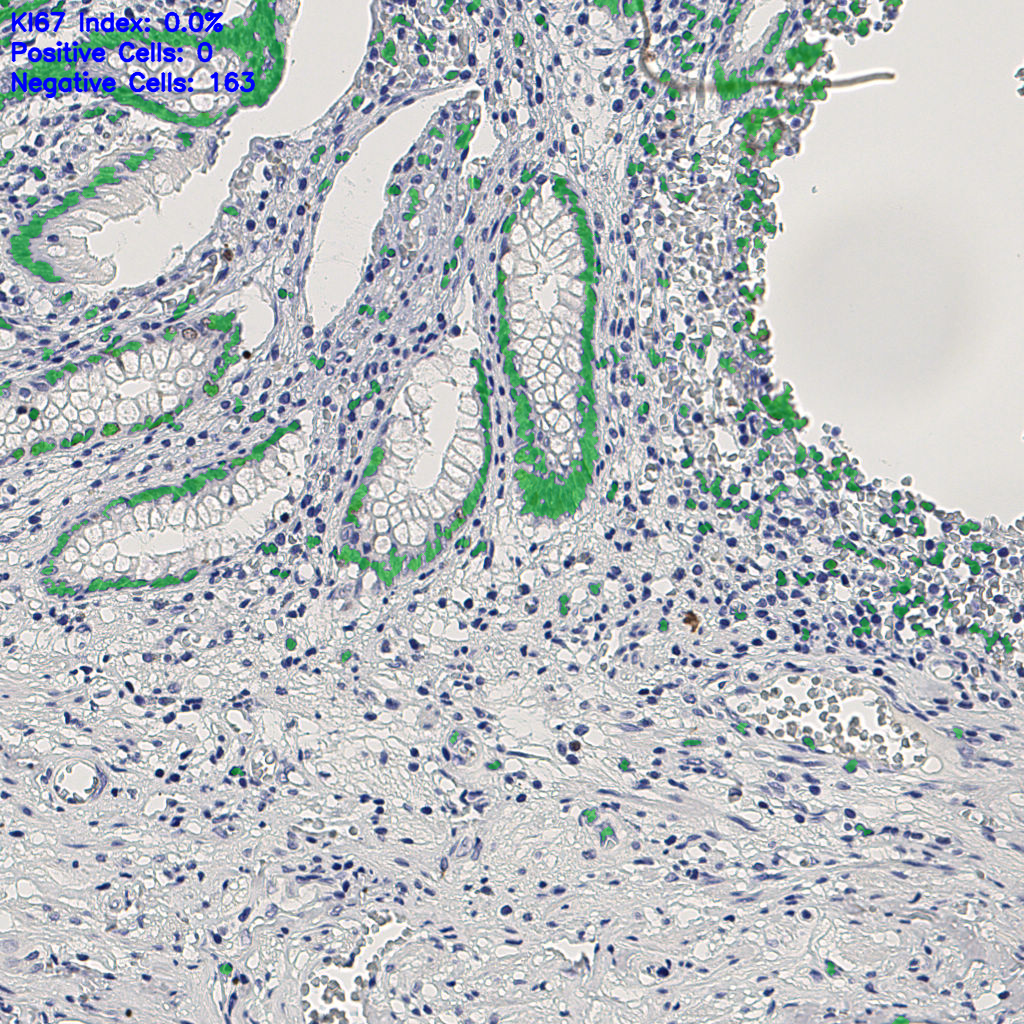 slice_7_26_x6272_y23296.png