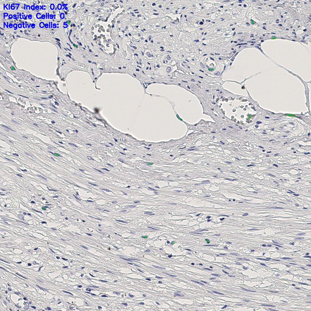 slice_7_27_x6272_y24192.png