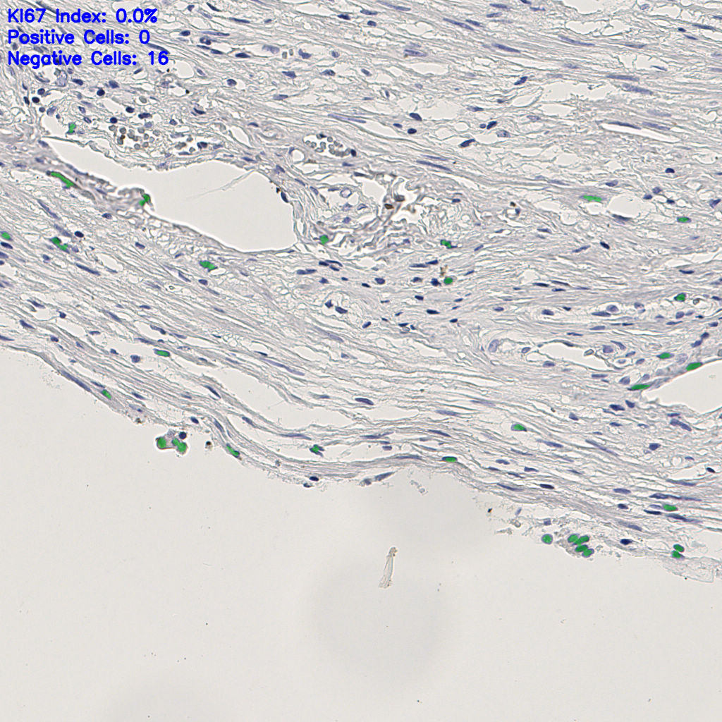 slice_7_28_x6272_y25088.png