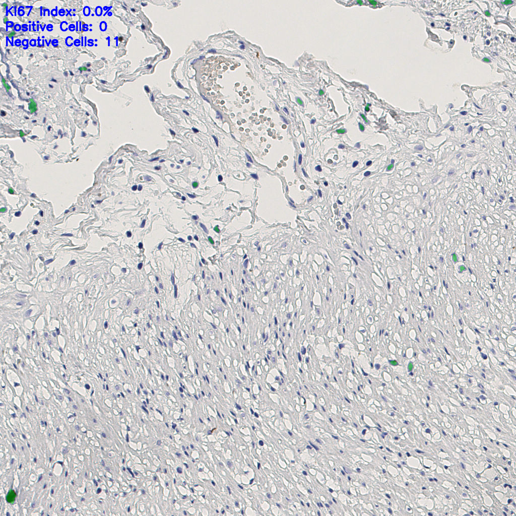 slice_8_19_x7168_y17024.png