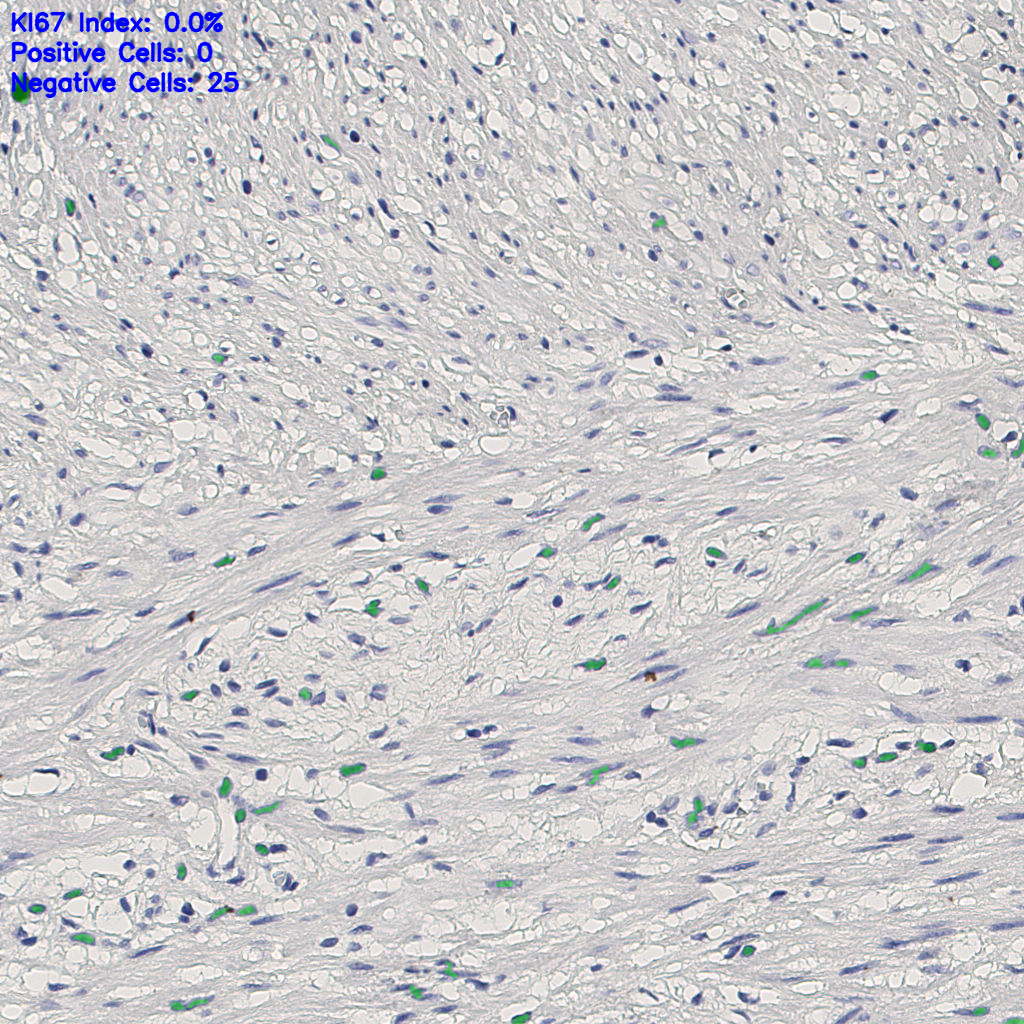 slice_8_20_x7168_y17920.png