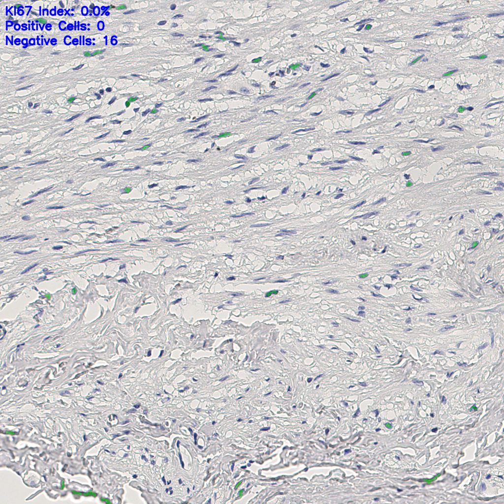 slice_8_21_x7168_y18816.png