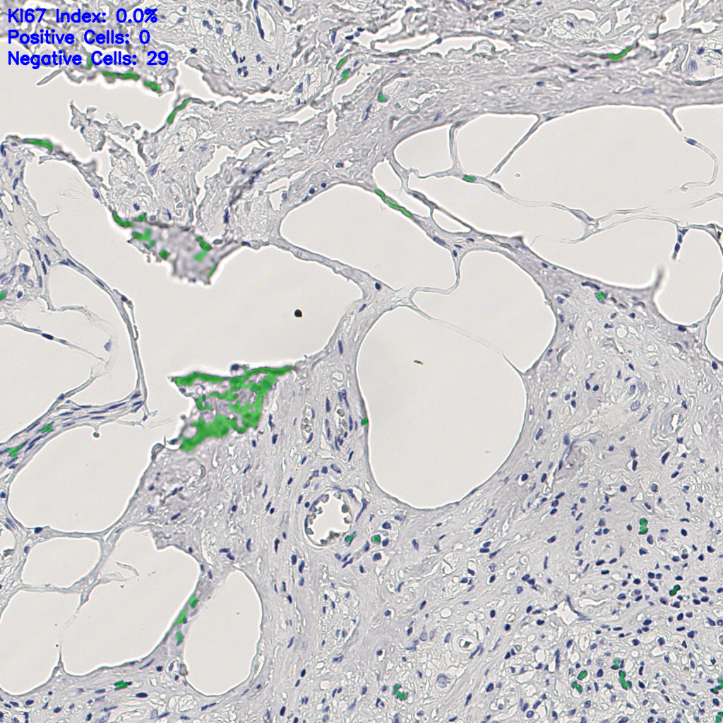 slice_8_22_x7168_y19712.png