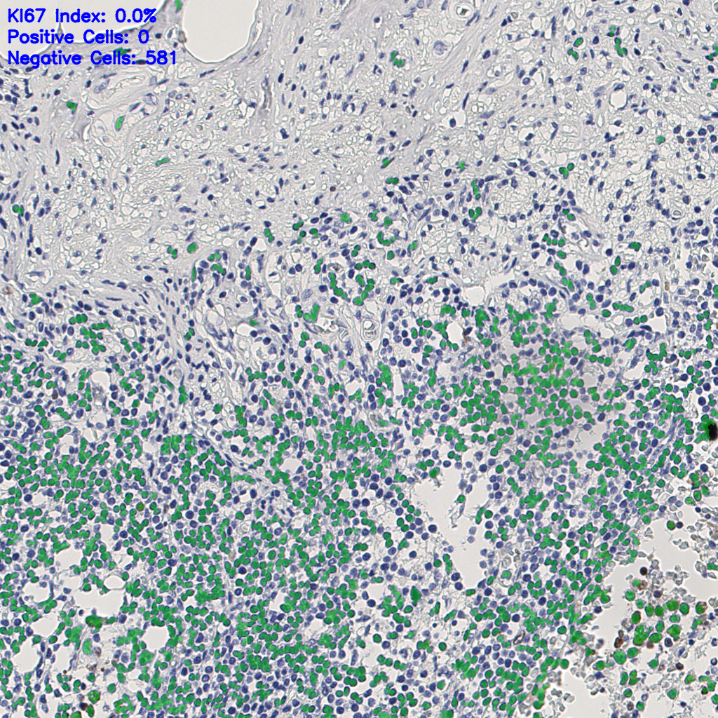 slice_8_23_x7168_y20608.png