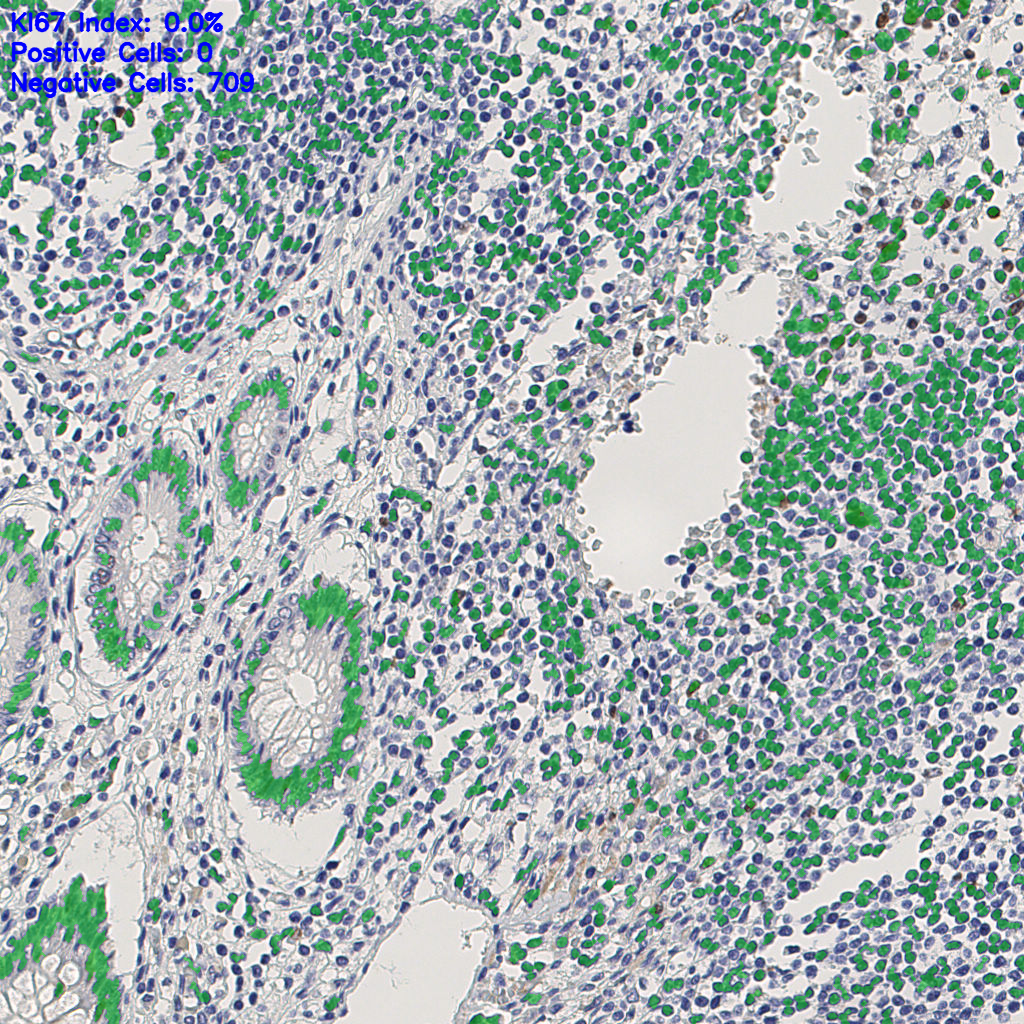 slice_8_24_x7168_y21504.png