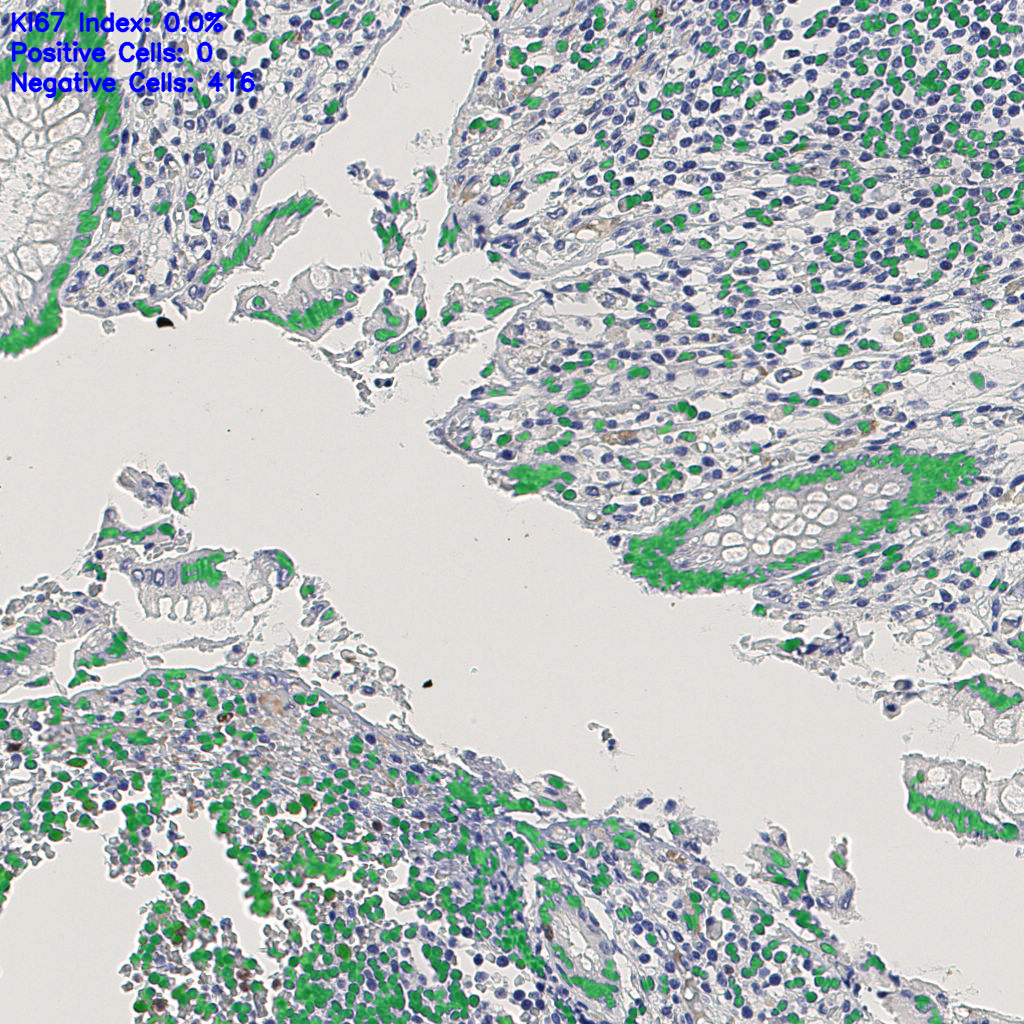 slice_8_25_x7168_y22400.png