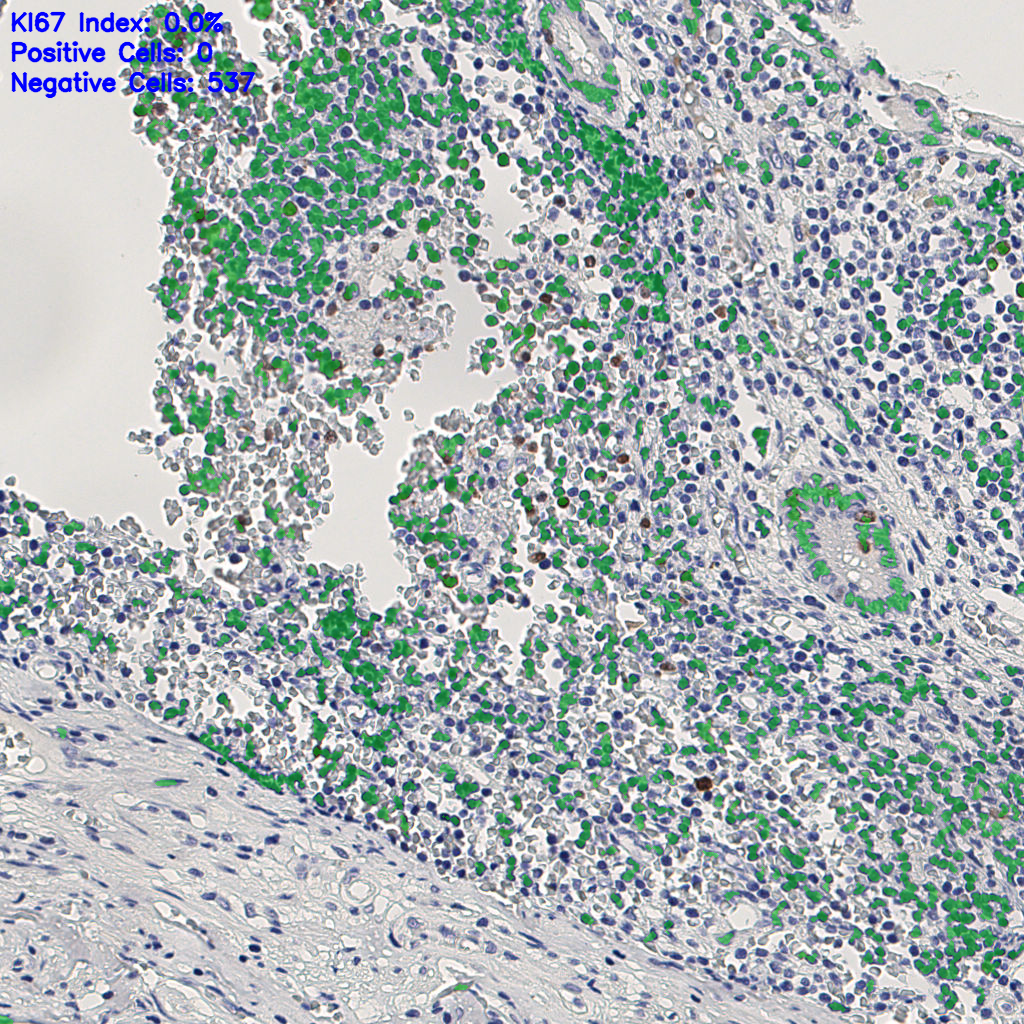 slice_8_26_x7168_y23296.png
