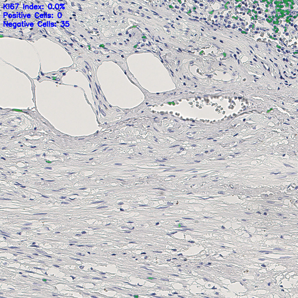 slice_8_27_x7168_y24192.png