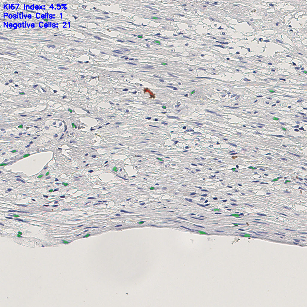 slice_8_28_x7168_y25088.png