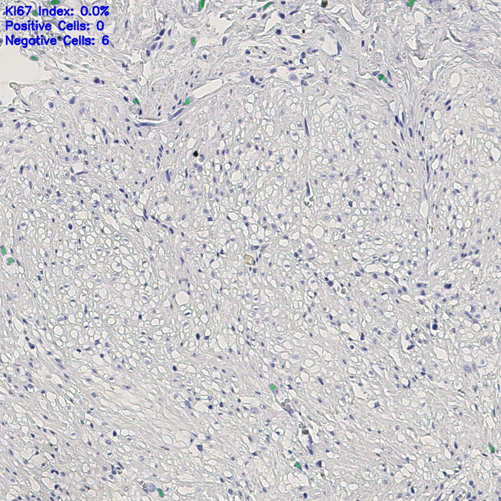 slice_9_19_x8064_y17024.png