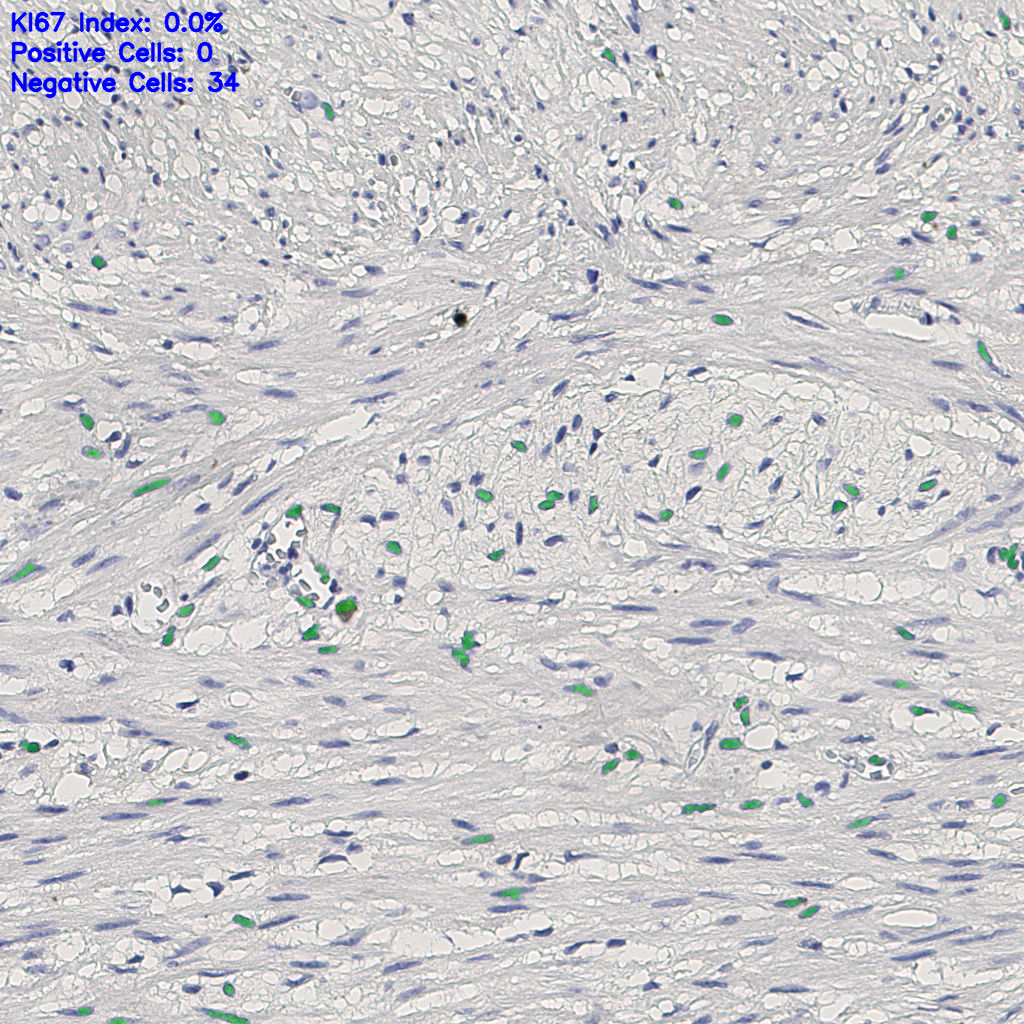 slice_9_20_x8064_y17920.png