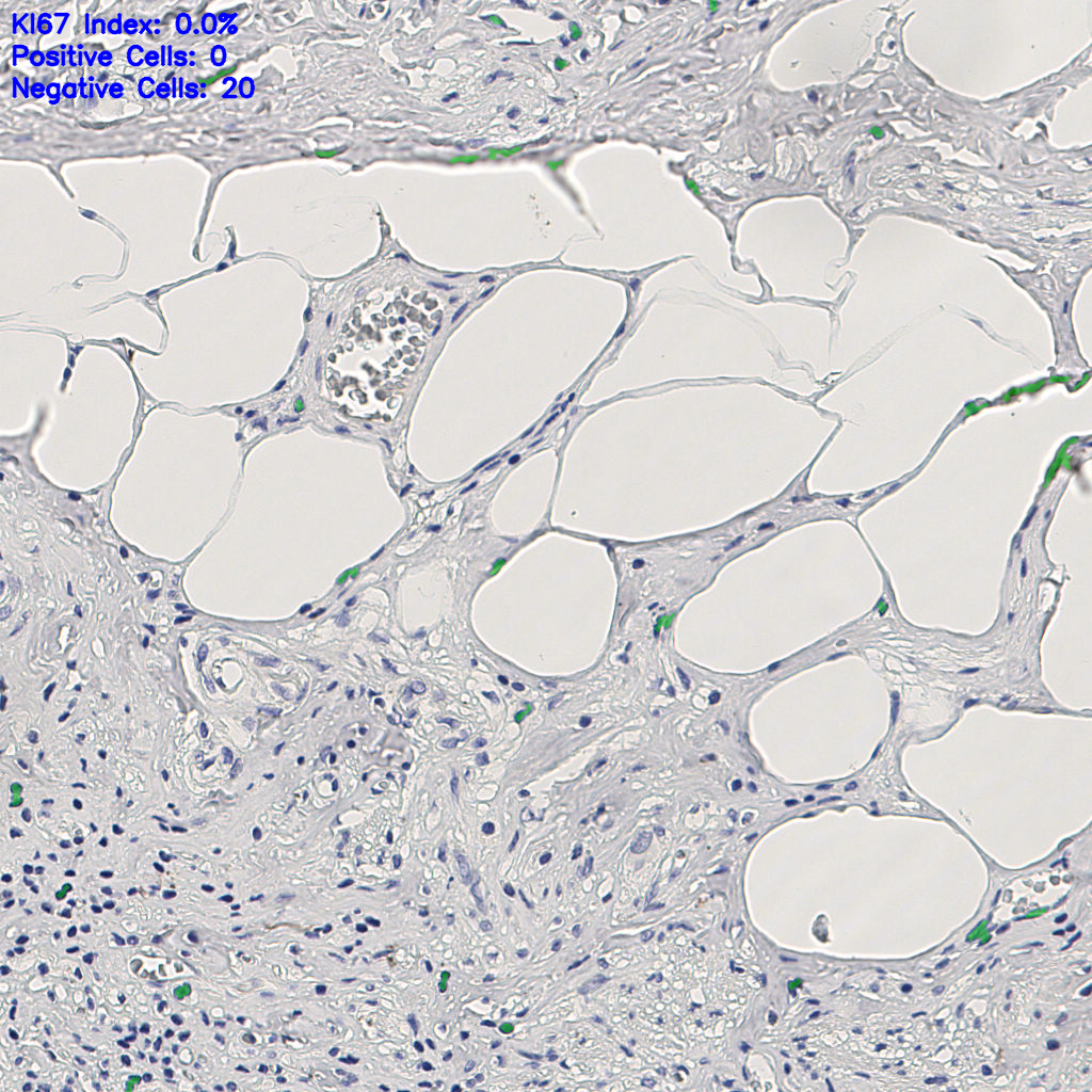 slice_9_22_x8064_y19712.png