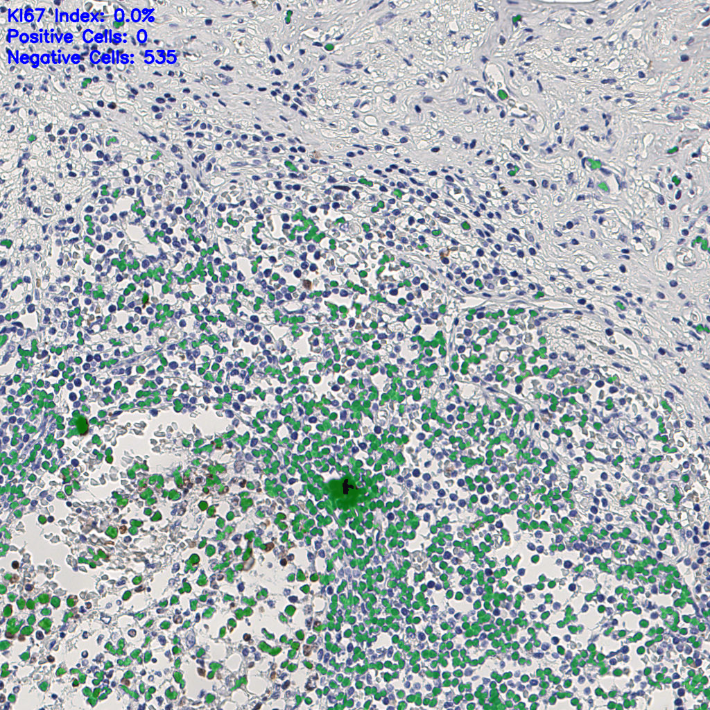 slice_9_23_x8064_y20608.png