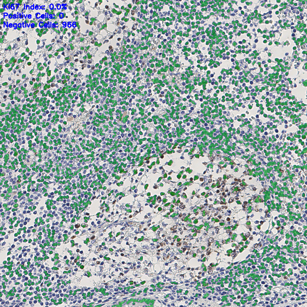 slice_9_24_x8064_y21504.png