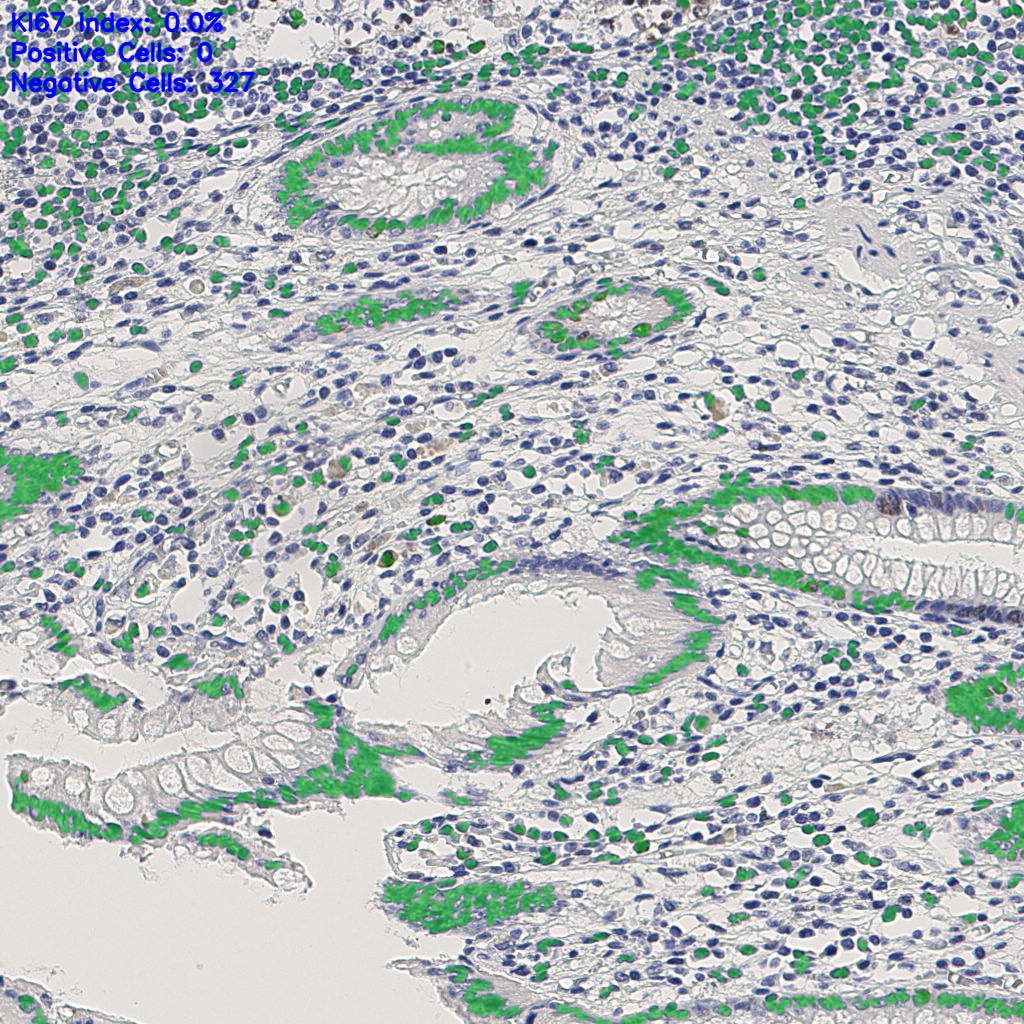 slice_9_25_x8064_y22400.png