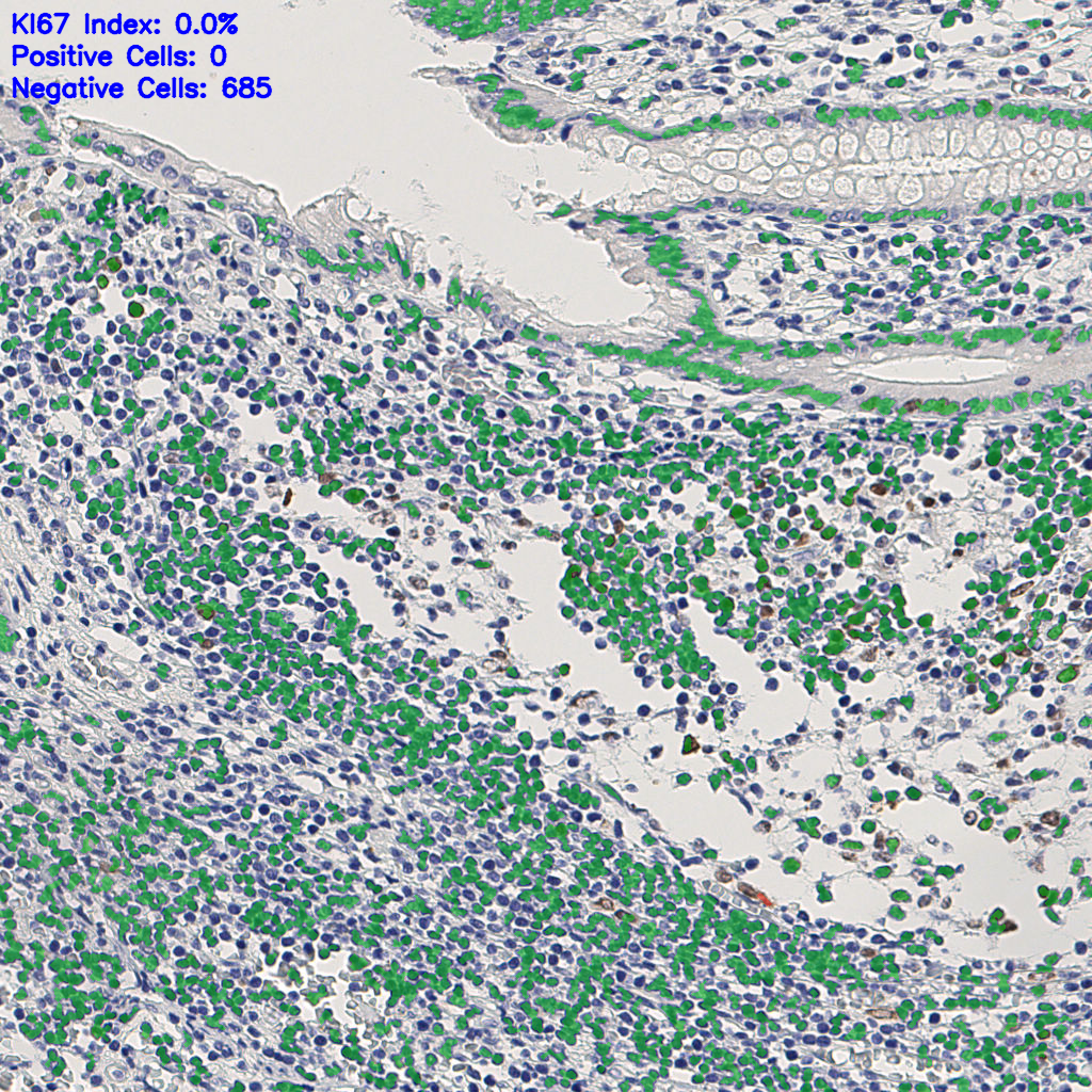slice_9_26_x8064_y23296.png