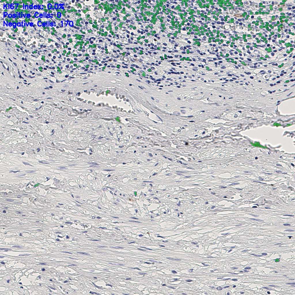slice_9_27_x8064_y24192.png