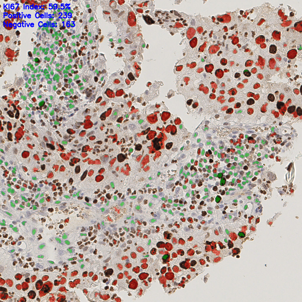 slice_10_20_x8960_y17920.png