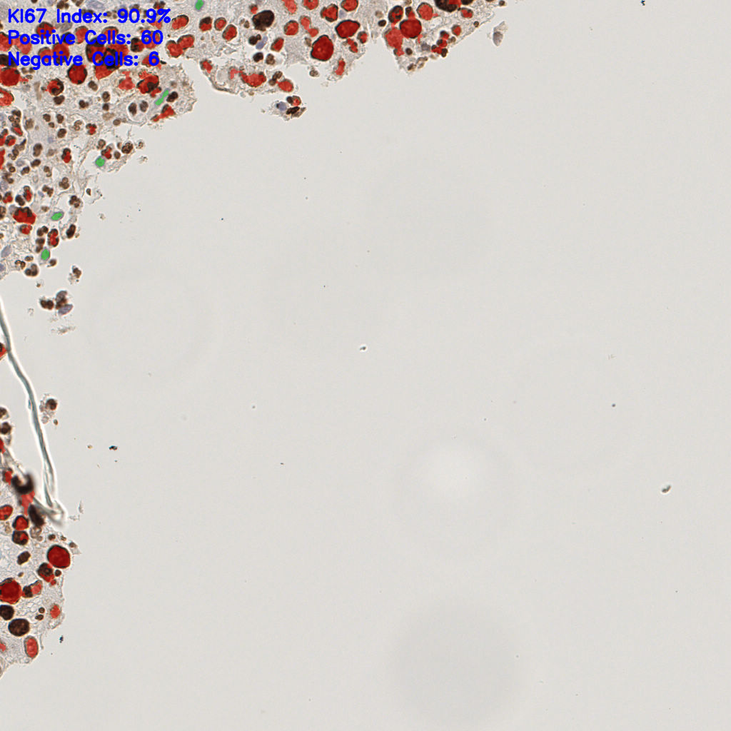 slice_10_21_x8960_y18816.png