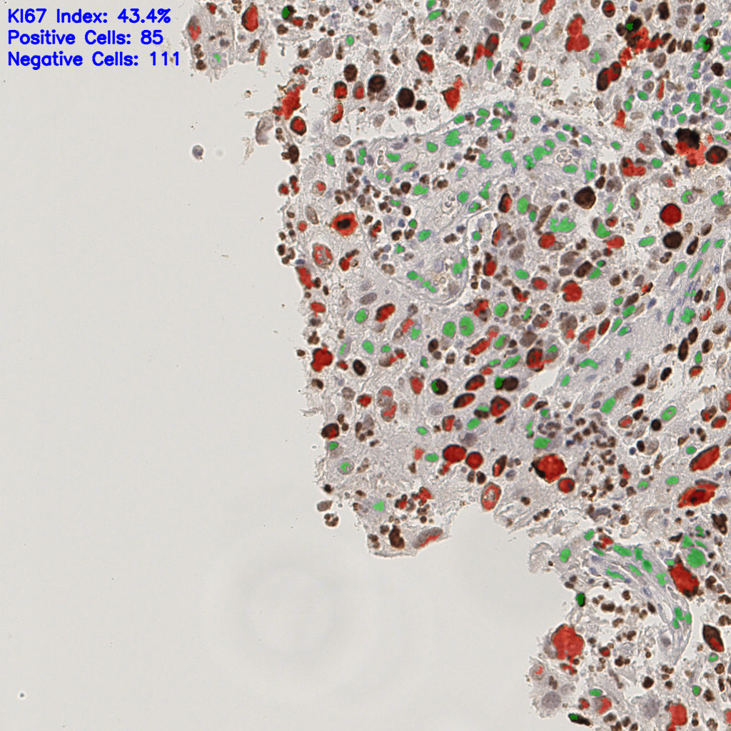 slice_14_12_x12544_y10752.png