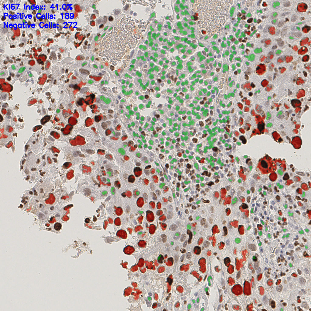 slice_15_13_x13440_y11648.png