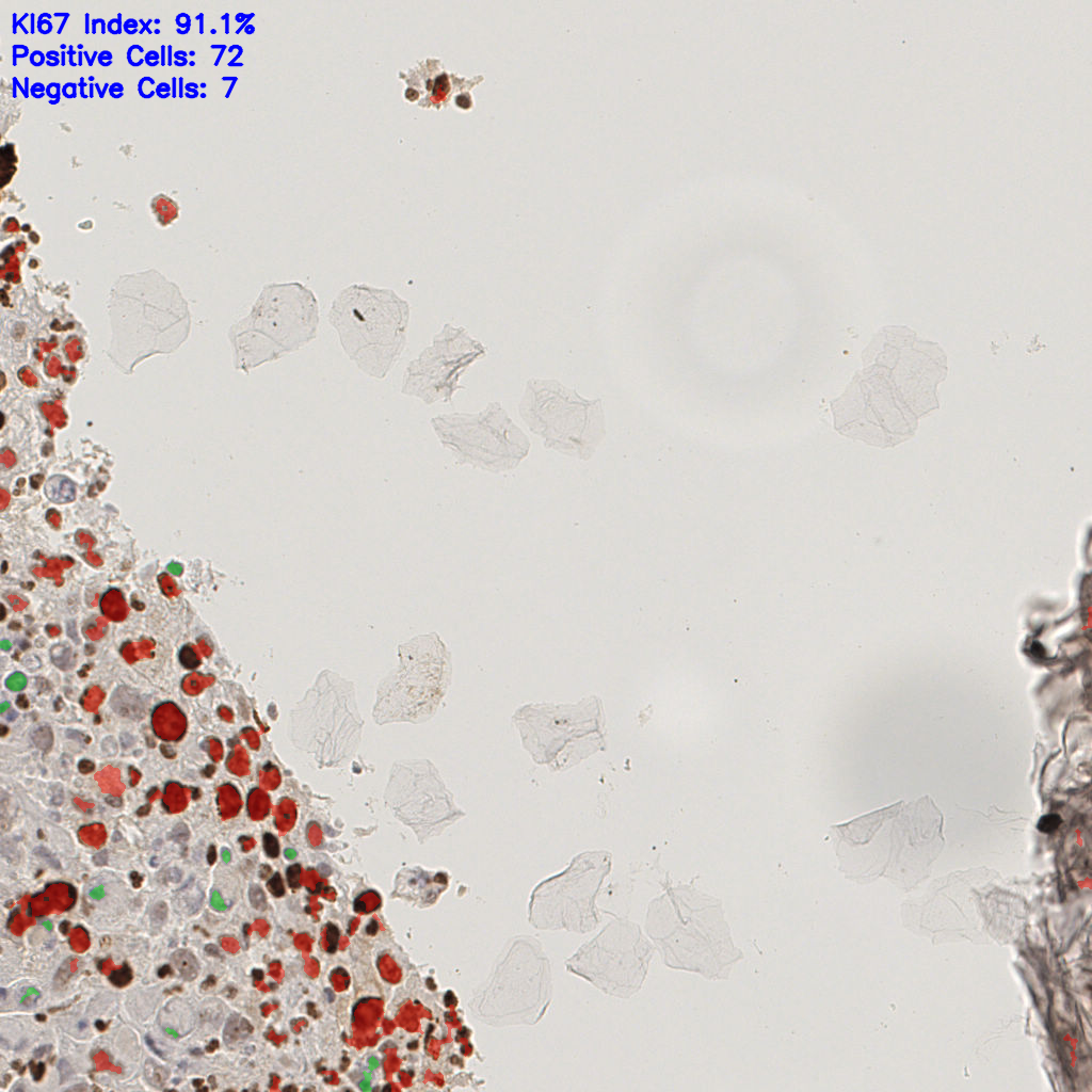 slice_16_11_x14336_y9856.png