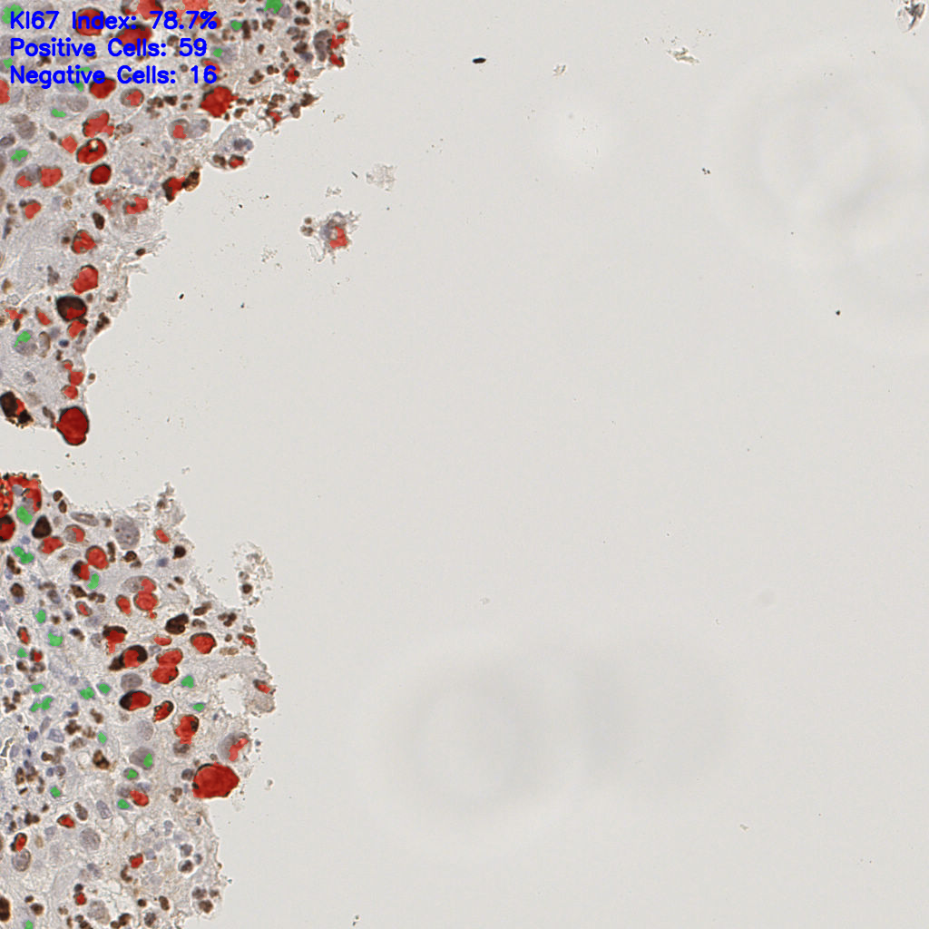 slice_16_13_x14336_y11648.png