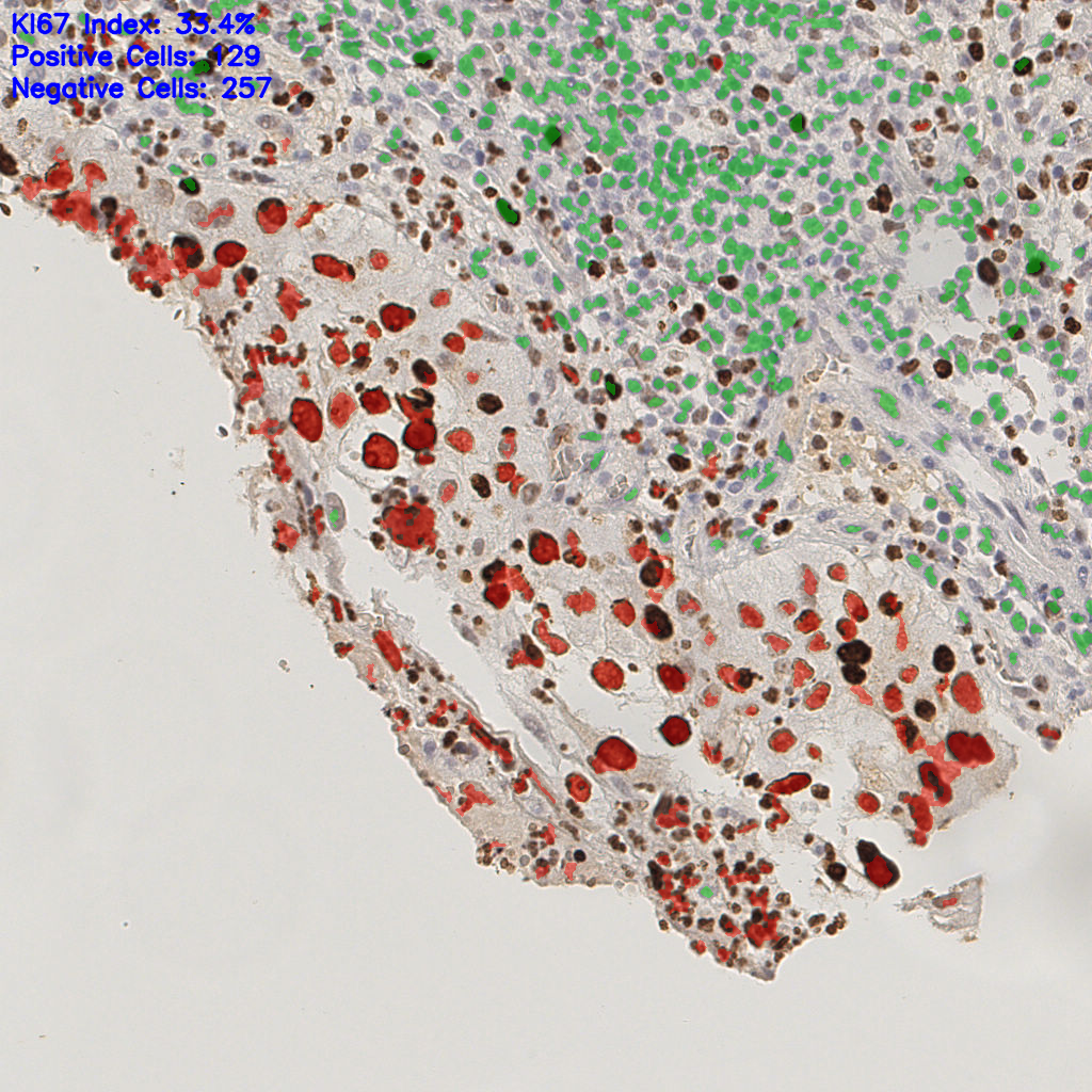 slice_16_19_x14336_y17024.png