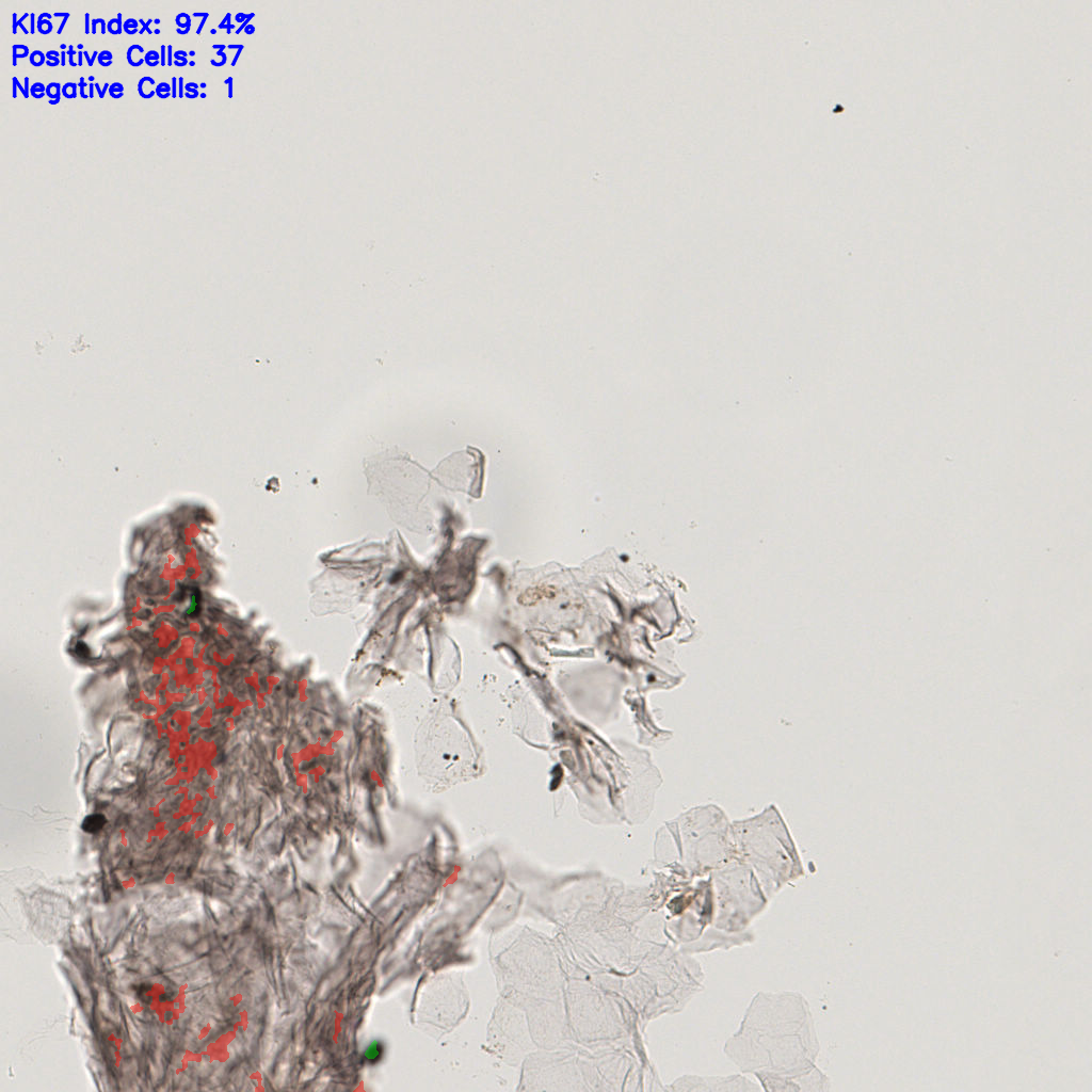 slice_17_11_x15232_y9856.png