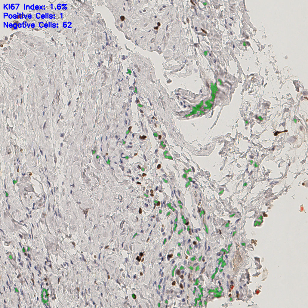 slice_17_30_x15232_y26880.png