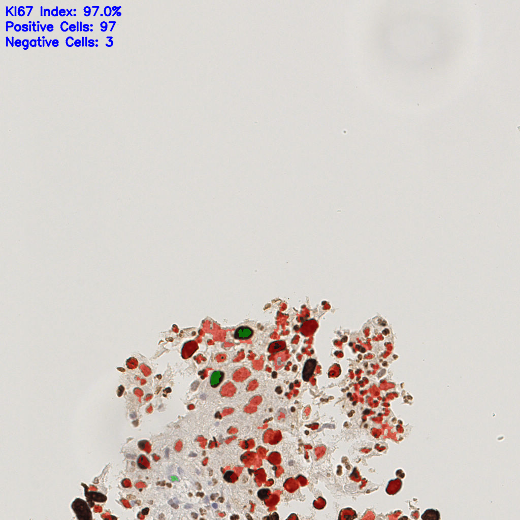 slice_18_15_x16128_y13440.png
