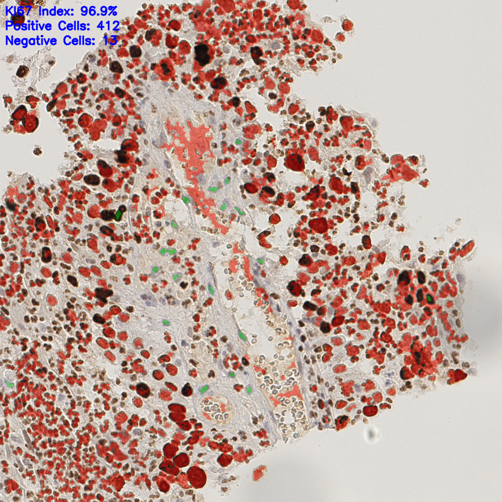 slice_19_18_x17024_y16128.png