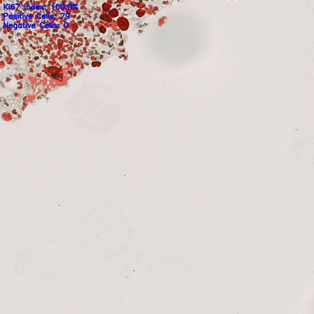 slice_19_19_x17024_y17024.png